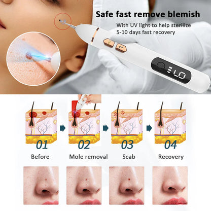Plasma Cosmetic Spot Remover Pen Adjustable