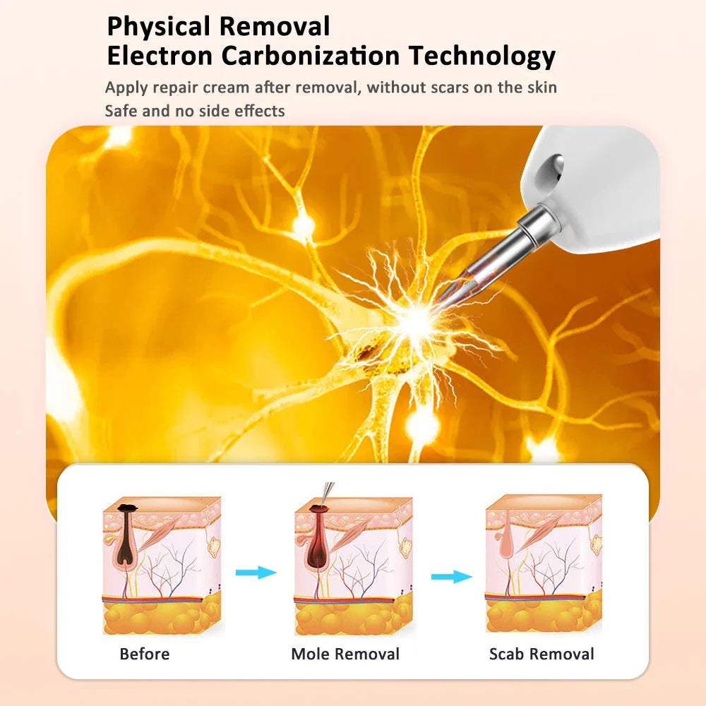 Plasma Cosmetic Spot Remover Pen Adjustable